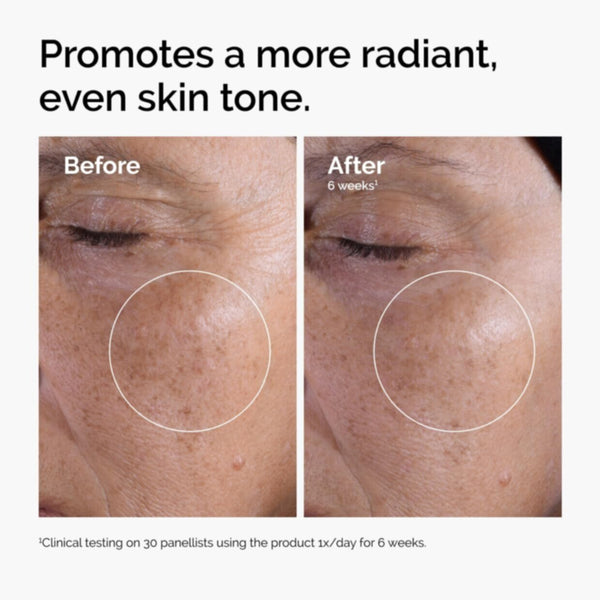 The Ordinary | Glycolic Acid 7% Toning Solution, Pack of 240ml liquid