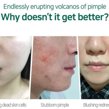 SOME BY MI | Aha Bha Pha 30 Days Miracle Cream | 8809326334224