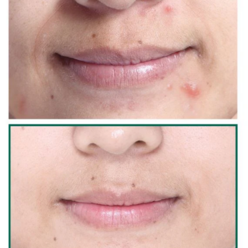 SOME BY MI | Aha Bha Pha 30 Days Miracle Cream | 8809326334224