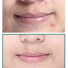 SOME BY MI | Aha Bha Pha 30 Days Miracle Cream | 8809326334224