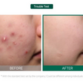 SOME BY MI | Aha Bha Pha 30 Days Miracle Cream | 8809326334224