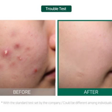 SOME BY MI | Aha Bha Pha 30 Days Miracle Cream | 8809326334224