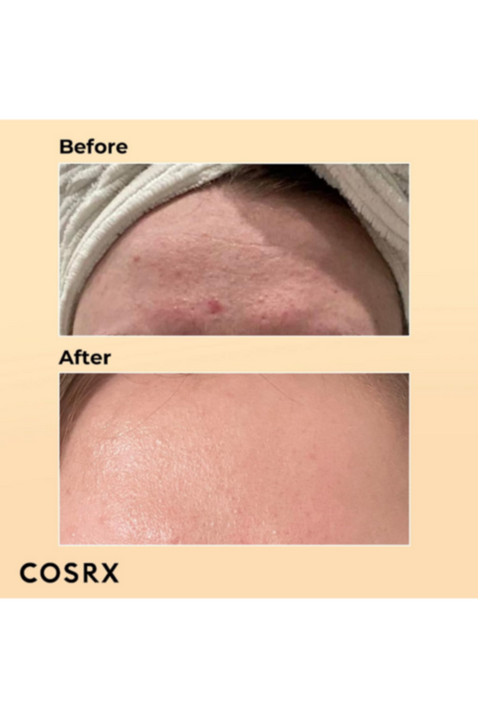 COSRX | Advance Snail 96 Mucin Power Essence 100ml