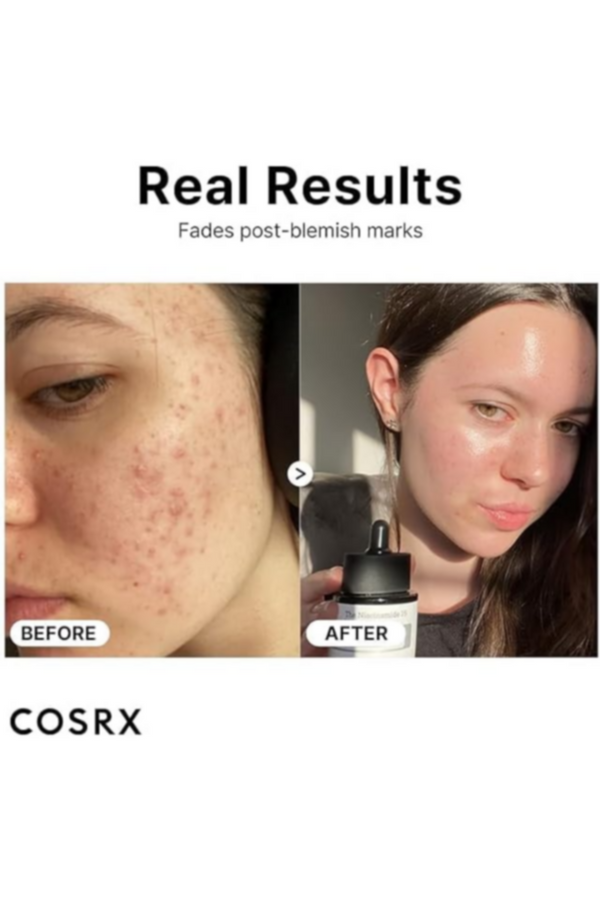 COSRX | The Niacinamide 15 Serum 20ml