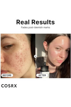 COSRX | The Niacinamide 15 Serum 20ml